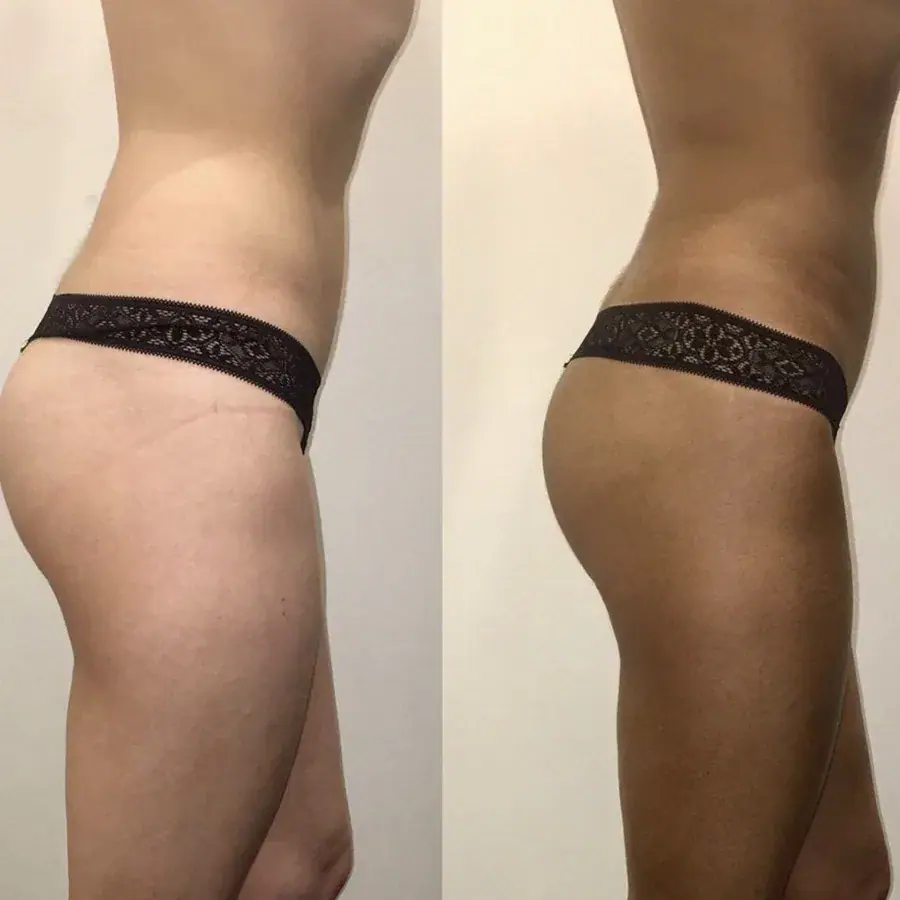Spray tan, before and after