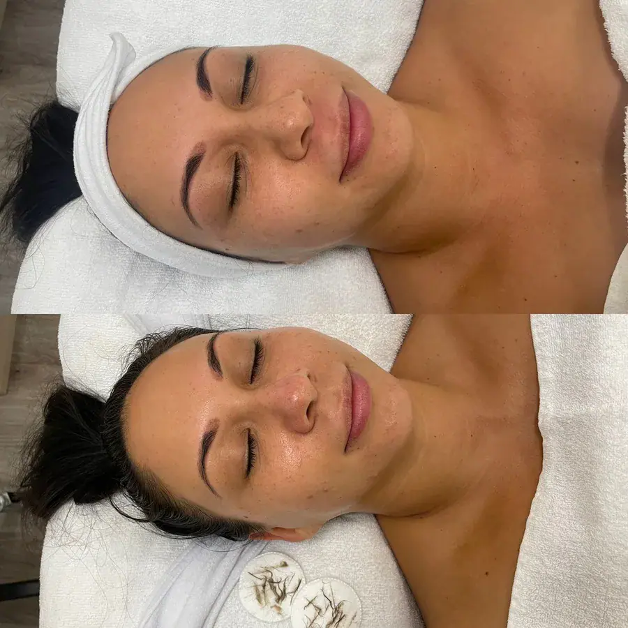 A client with a treatment mask applied during a facial