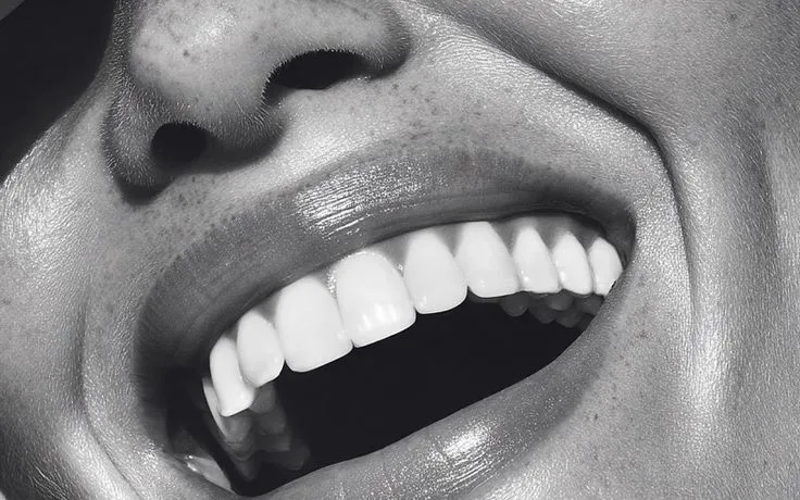 Black and white portrait of a freckled woman laughing